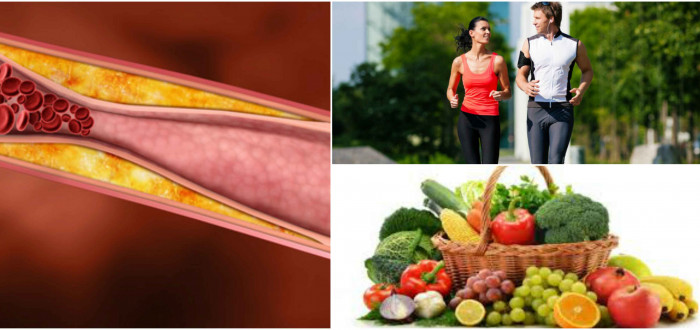 Prevencí proti ateroskleróze je nejlépe pohyb a vyvážená strava