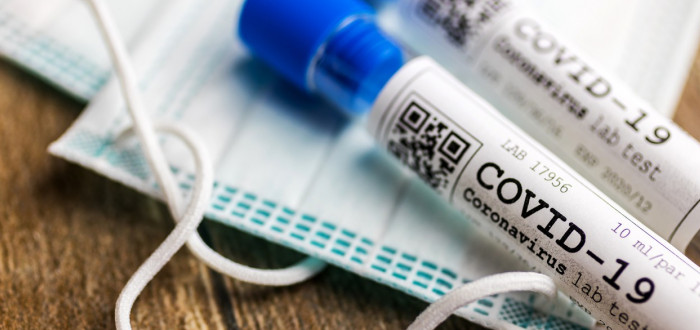 V České republice se objevily první tři případy koronaviru