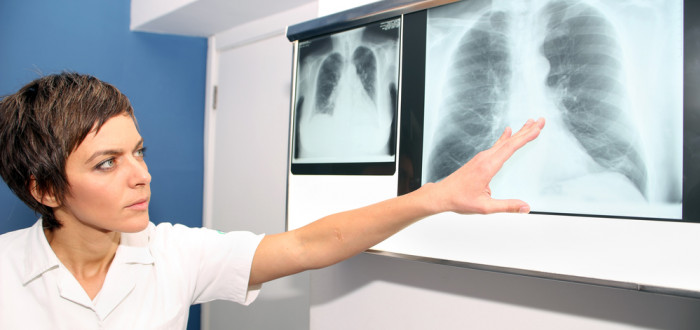 Při plicní hypertenzi dochází ke zvýšené námaze pravé komory srdeční, která se postupně zvětšuje