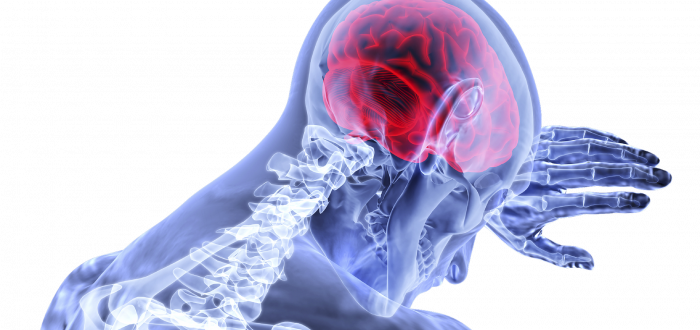 K cévní mozkové příhodě dochází, když se přívod krve do určité části mozku náhle zastaví nebo sníží