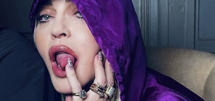 Madonna šokovala fanoušky na instagramu obrovskou modřinou