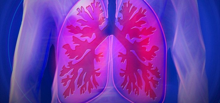 Příčinou škytavky může být silný zápal plic nebo rakovina