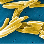 Mycobacterium tuberculosis – původce TBC v elektronovém mikroskopu