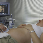 To, zda je miminko zdravé je možné určit i pomocí ultrazvuku