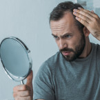 Mezi rizikové faktory vzniku alopecie patří mimo jiné obyčejný stres