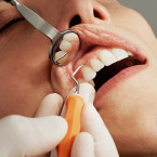 Používání zubní nitě až příliš často nebo s přílišnou intenzitou může vyústit v onemocnění dásní