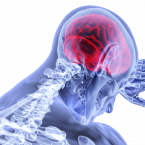 K cévní mozkové příhodě dochází, když se přívod krve do určité části mozku náhle zastaví nebo sníží