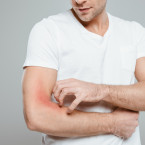 Svědění kůže může být příznakem rakoviny i HIV