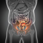 Nemoci jako Crohnova nemoc nebo ulcerózní kolitida jsou tzv. imunitně podmíněná onemocnění, tedy způsobuje je vlastní imunitní systém pacienta