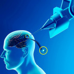 Prvotním cílem implantace čipu do mozku člověka je, aby byli lidé bez končetin schopni ovládat počítače