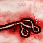Ebola představuje jednu z nejnebezpečnějších nákaz, s jakou se kdy lidstvo setkalo. Původcem onemocnění je filovirus ebola