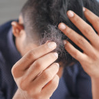 Nadměrnému padání vlasů můžete zabránit poměrně lehce s pomocí esenciálních olejů
